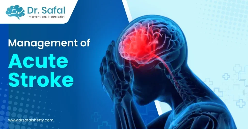 Management of Acute Stroke | Early Treatment That Saves Lives