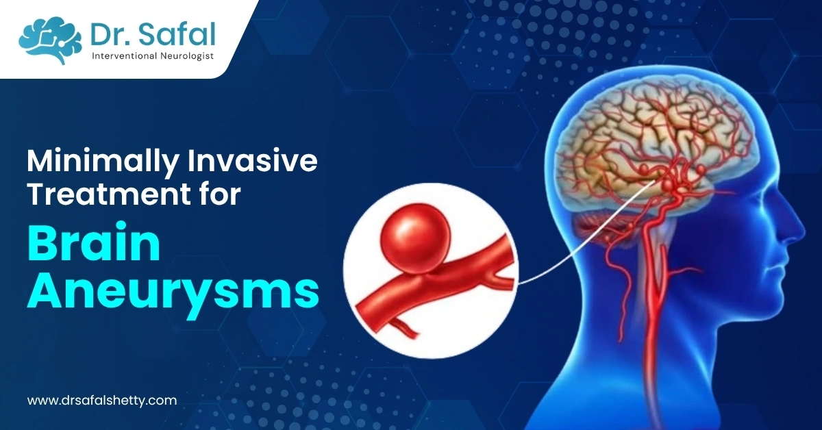 Brain Aneurysms