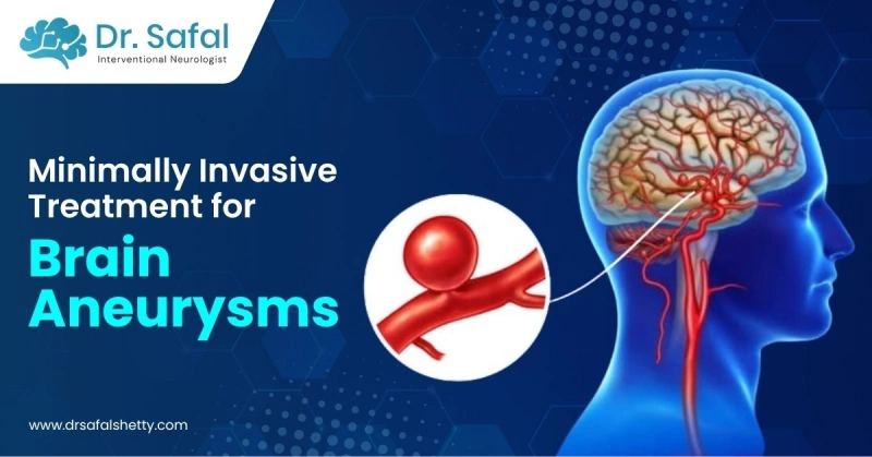 Minimally Invasive Treatment for Brain Aneurysms