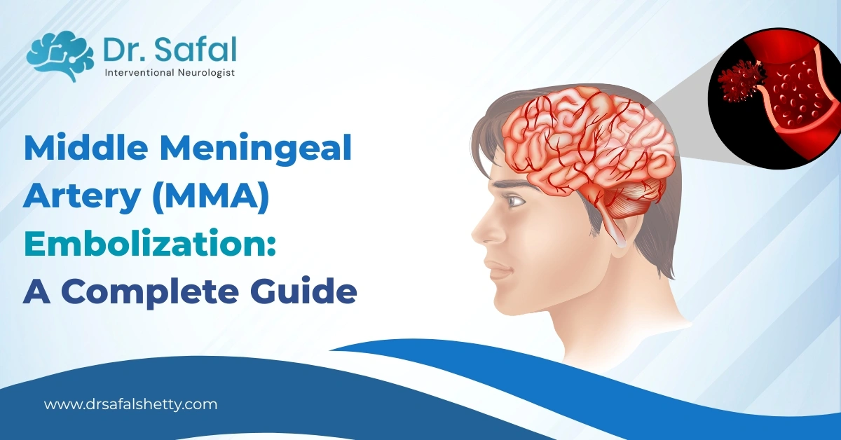 Middle Meningeal Artery (MMA)
