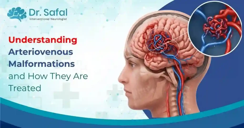 Understanding Arteriovenous Malformations and How They Are Treated
