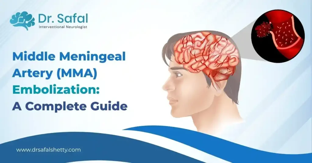 Middle Meningeal Artery (MMA) Embolization: A Complete Guide